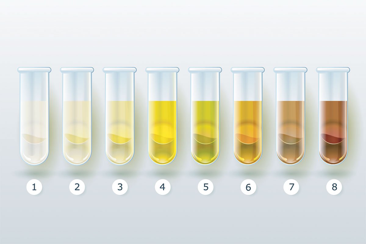 Scale of urine colors to measure hydration